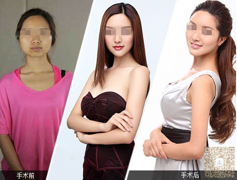 纹绣shì什么样得美容术