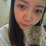 你看我做了超声波去眼袋手术后的样子会不会也心动呢114