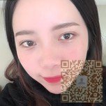 你看我做了超声波去眼袋手术后的样子会不会也心动呢114