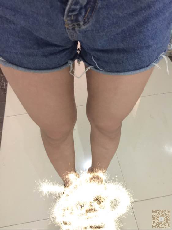 超声波减肥两周啦,给大家看看哦255 超声波减肥两周啦,给大家看看哦255