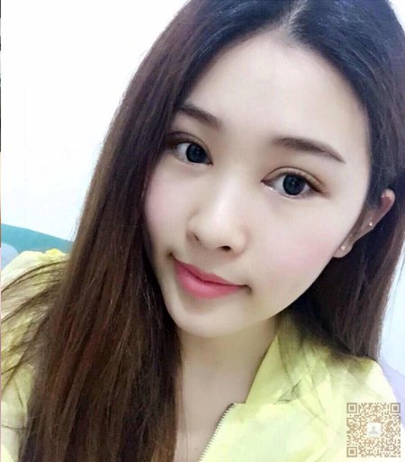 做le超 声 波双眼 皮手术，wǒ也有漂亮得双眼 皮啦