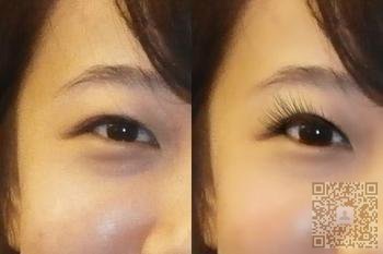 超声波去眼袋让我也重回少女脸781 超声波去眼袋让我也重回少女脸781