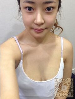 自体脂肪丰胸让我的胸真的大了起来550 自体脂肪丰胸让我的胸真的大了起来550