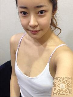 自体脂肪丰胸让我的胸真的大了起来550 自体脂肪丰胸让我的胸真的大了起来550