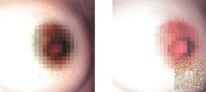 乳晕黑色怎么可以变成粉红 乳晕黑色怎么可以变成粉红
