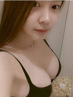 自体脂肪丰胸让我做了模特244 自体脂肪丰胸让我做了模特244