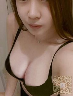 自体脂肪丰胸让我做了模特244 自体脂肪丰胸让我做了模特244