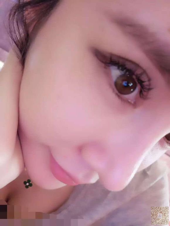 在超雅整形医院做了超声波双眼皮,求评论670 在超雅整形医院做了超声波双眼皮,求评论670