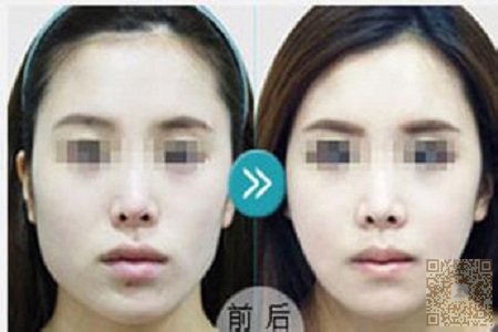 瘦脸方法大全 瘦脸方法大全
