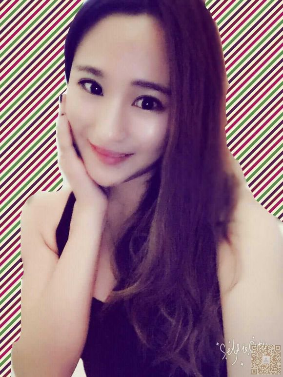 去超雅整形医院做了超声波双眼皮，恢复完毕，特来报到387
