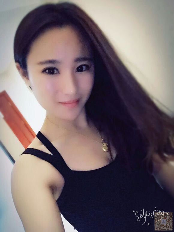 去超雅整形医院做了超声波双眼皮，恢复完毕，特来报到387