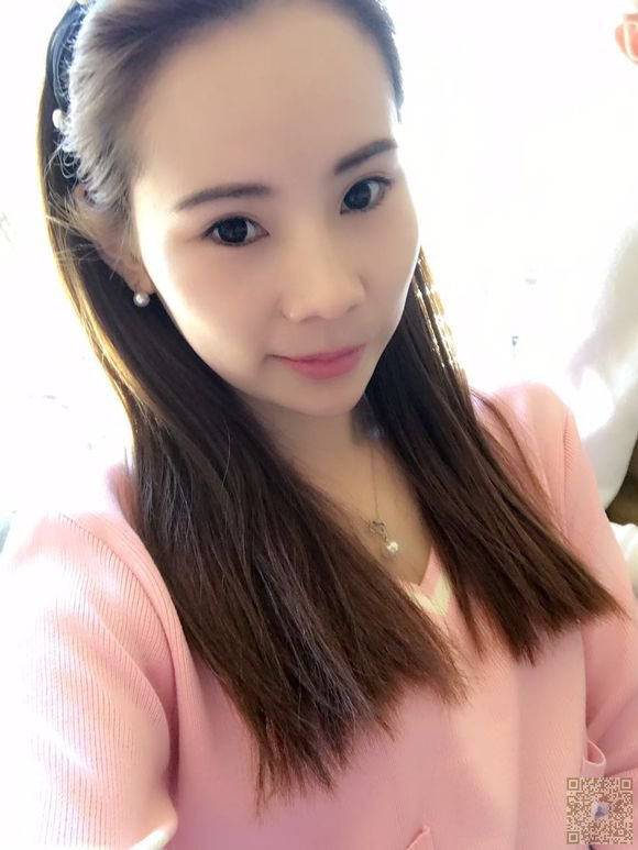 在超雅整形医院做的超声波双眼皮恢复的很不错了，来看看吧860