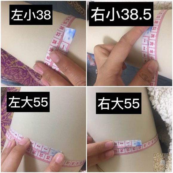 吸脂经历——超雅整形医院得超 声 波减肥之行 吸脂经历——超雅整形医院得超 声 波减肥之行