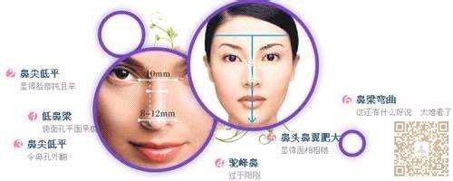 假体隆鼻有副作用吗?282 假体隆鼻有副作用吗?282