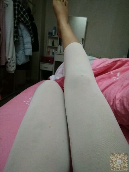 超 声 波减肥术后恢复不错,晒晒晒 超 声 波减肥术后恢复不错,晒晒晒