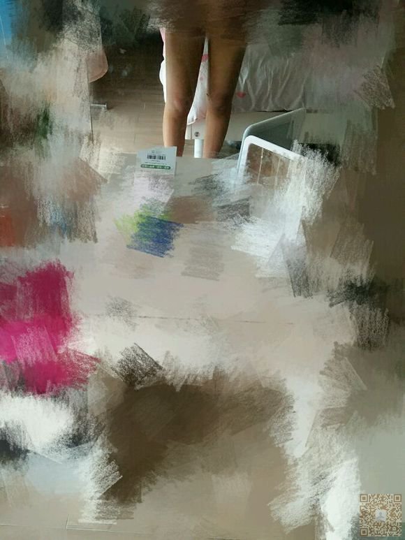 超 声 波减肥术后恢复不错,晒晒晒 超 声 波减肥术后恢复不错,晒晒晒