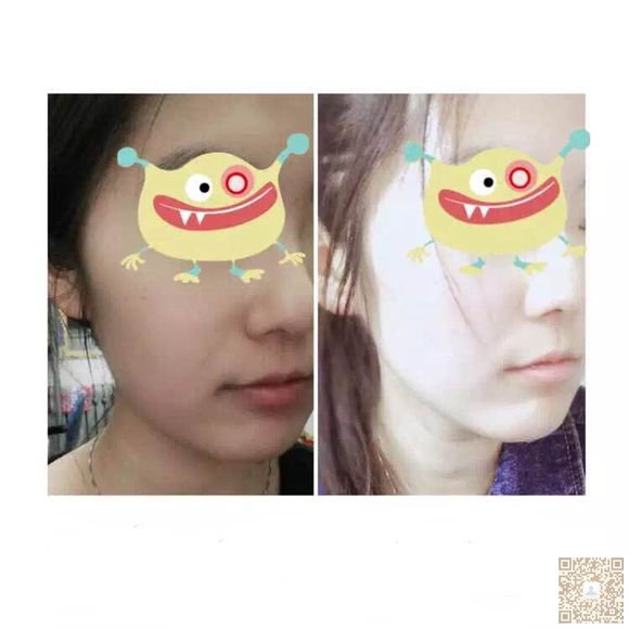 超 声 波双下巴大学生得福音 超 声 波双下巴大学生得福音