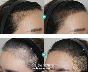半永久发际线之后,像赵丽颖ー样自信 半永久发际线之后,像赵丽颖ー样自信