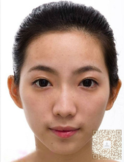 超声波去眼袋解决了我的工作问题742 超声波去眼袋解决了我的工作问题742