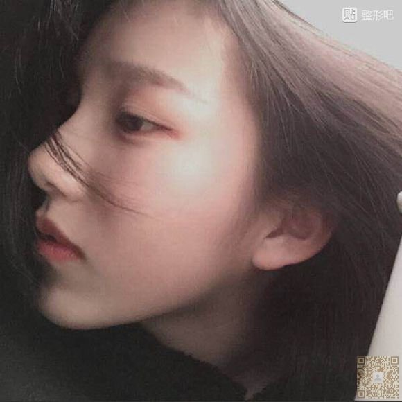 超声波双眼皮——让你美的极致684