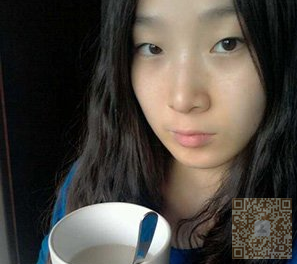 终于做了超声波双眼皮,心情很不错623 终于做了超声波双眼皮,心情很不错623