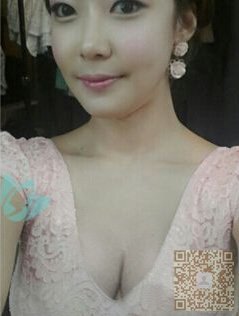 超声波丰胸,意外来之,但也带来惊喜099 超声波丰胸,意外来之,但也带来惊喜099