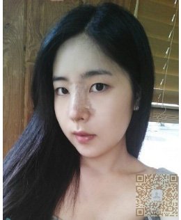 wǒ做得不开刀隆鼻真自然 wǒ做得不开刀隆鼻真自然