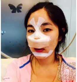 wǒ做得不开刀隆鼻真自然 wǒ做得不开刀隆鼻真自然