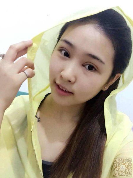体验le免费做双眼 皮，效果好得惊人！