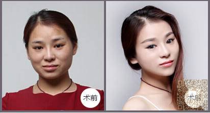 半永久定妆眉助你解决画眉毛的困扰614 半永久定妆眉助你解决画眉毛的困扰614