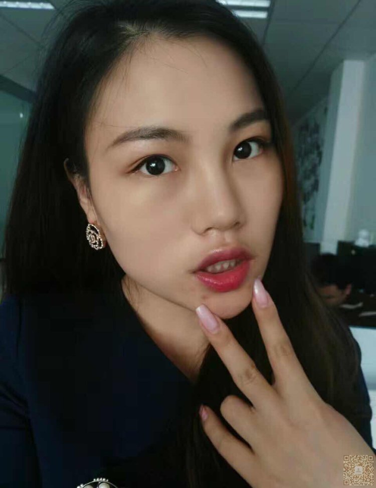 超声波美白祛斑给我婴儿般的滑嫩肌肤478 超声波美白祛斑给我婴儿般的滑嫩肌肤478