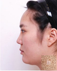 我感谢超声波瘦脸571 我感谢超声波瘦脸571