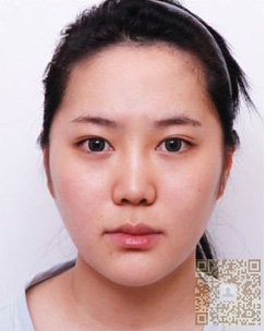 我感谢超声波瘦脸571 我感谢超声波瘦脸571
