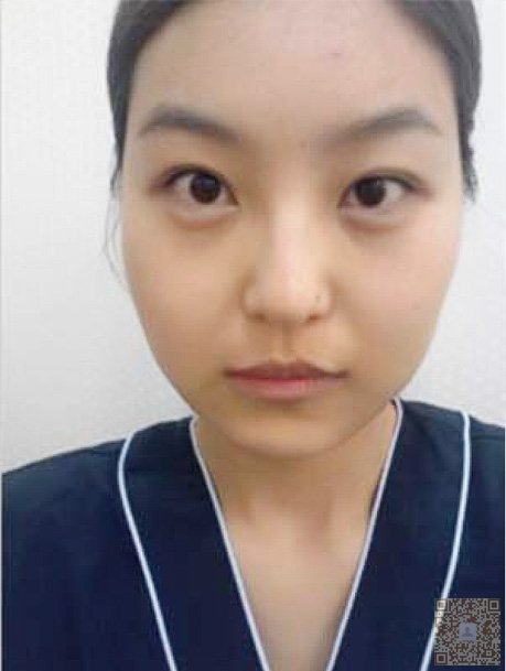 超 声 波美白让晒黑无处遁寻 超 声 波美白让晒黑无处遁寻