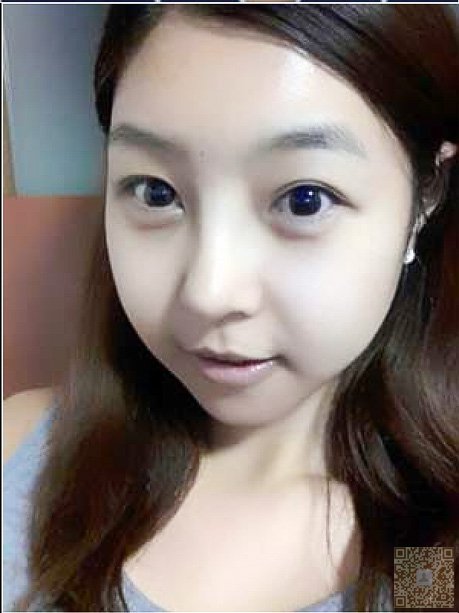 超 声 波美白让晒黑无处遁寻 超 声 波美白让晒黑无处遁寻