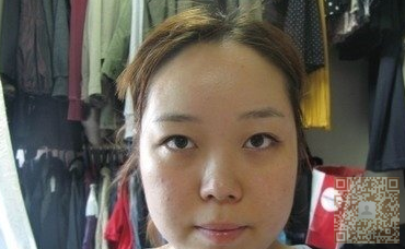 超声波去双下巴真的可以去掉双下巴呢，经验分享哦227