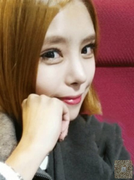 超声波美白让我成为最美新娘652 超声波美白让我成为最美新娘652