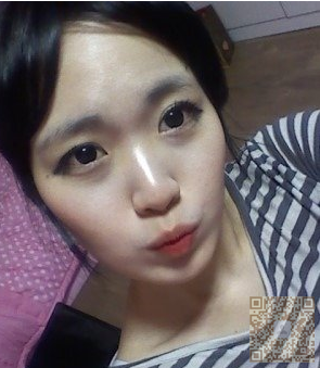 超 声 波去双下巴让wǒ术后美美哒 超 声 波去双下巴让wǒ术后美美哒