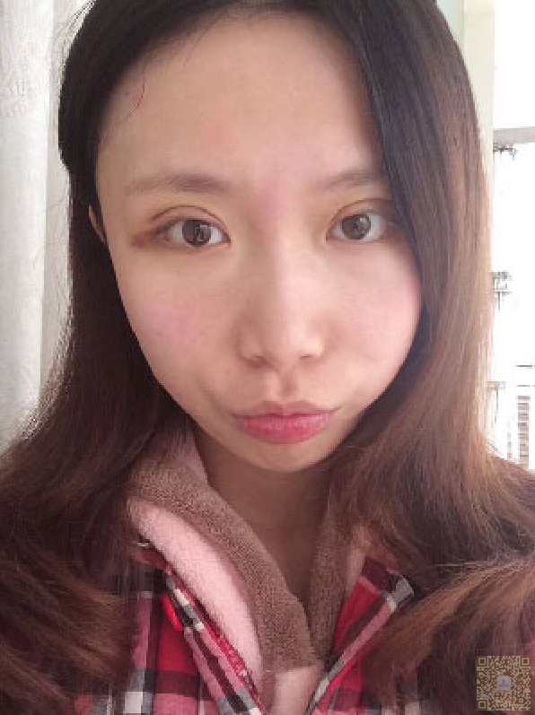 做le超 声 波双眼 皮wǒ变得更加年轻le