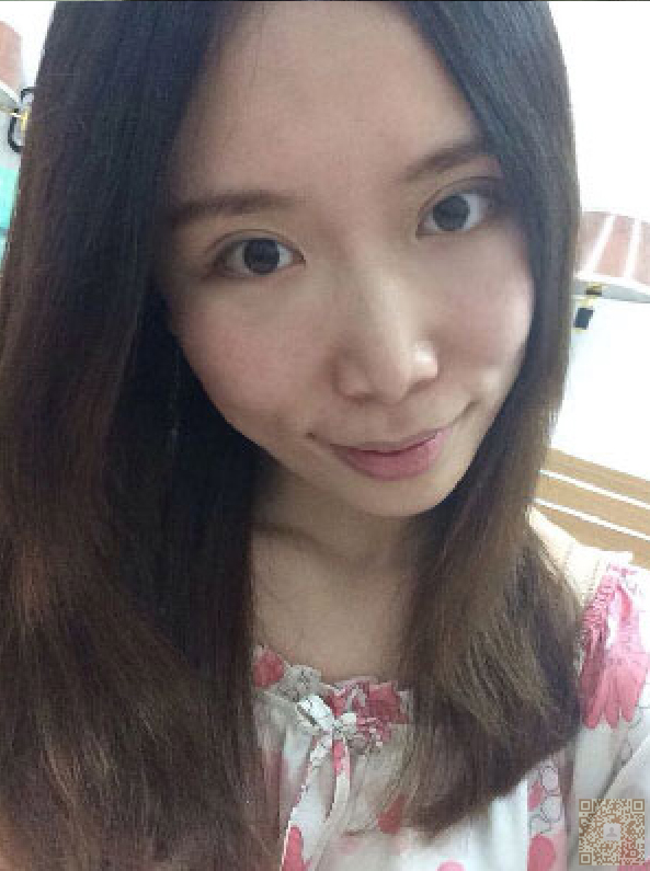 做le超 声 波双眼 皮wǒ变得更加年轻le