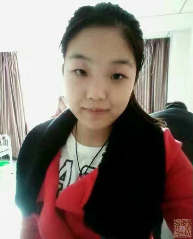 超声波减肥帮我摆脱药物肥胖277