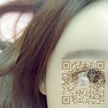 一次超声波双眼皮手术就能带来巨大改变801 一次超声波双眼皮手术就能带来巨大改变801
