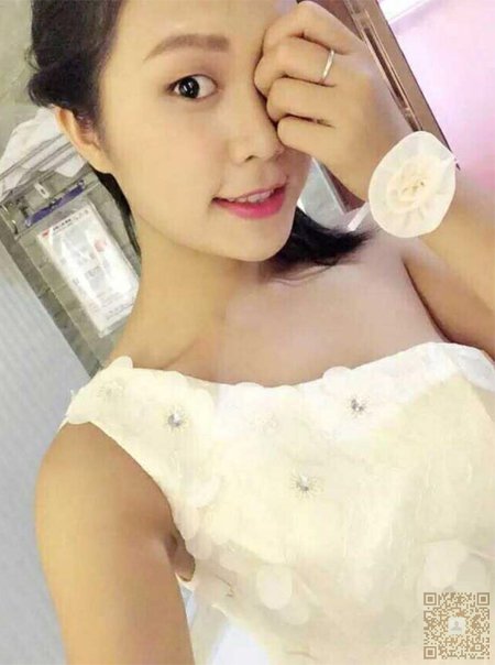雪儿做了超声波双眼皮以后变的更美了064