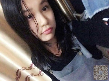 雪儿做了超声波双眼皮以后变的更美了064