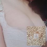 超雅超声波自体脂肪丰胸手术给我丰满少女胸177 超雅超声波自体脂肪丰胸手术给我丰满少女胸177
