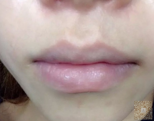 做le半永久眉毛以后又来做水晶唇 做le半永久眉毛以后又来做水晶唇