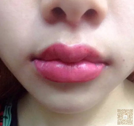 做le半永久眉毛以后又来做水晶唇 做le半永久眉毛以后又来做水晶唇