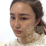 来超雅做不开刀隆鼻啦269 来超雅做不开刀隆鼻啦269