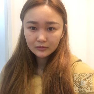来超雅做不开刀隆鼻啦269 来超雅做不开刀隆鼻啦269