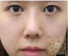 中年大妈面容宛若少女，全靠彭氏童颜术